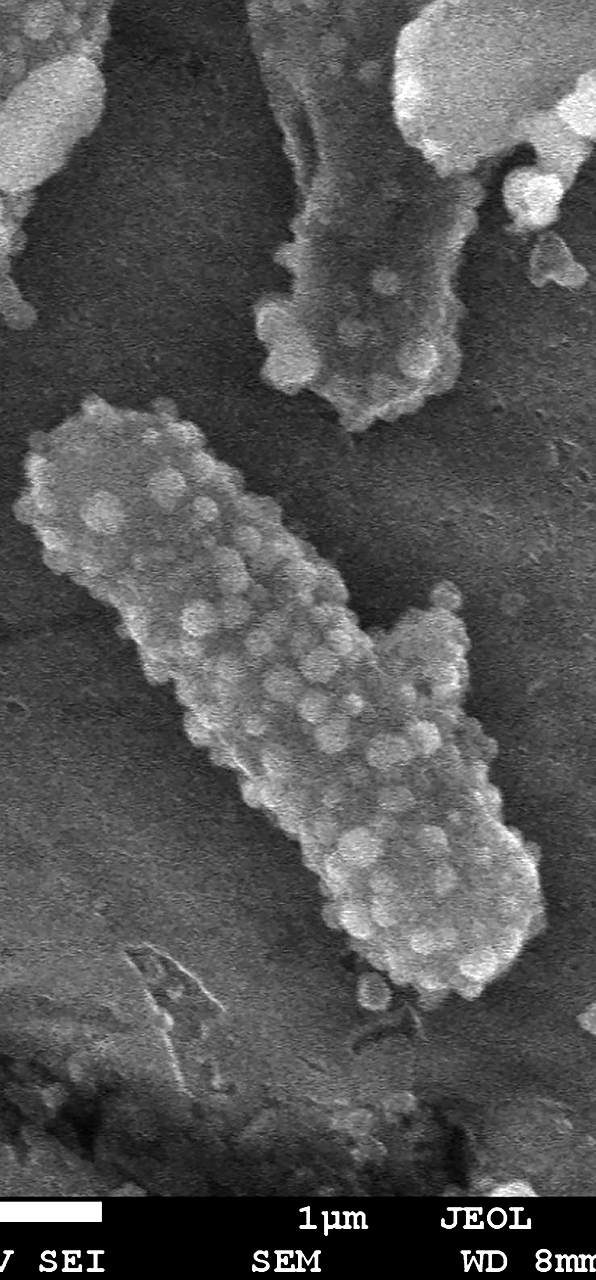 Imagen de bacterias de E.colli con las nanoparticulas en su superficie