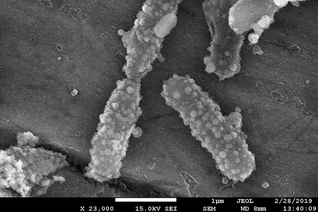 Imagen de bacterias de E.colli con las nanoparticulas en su superficie